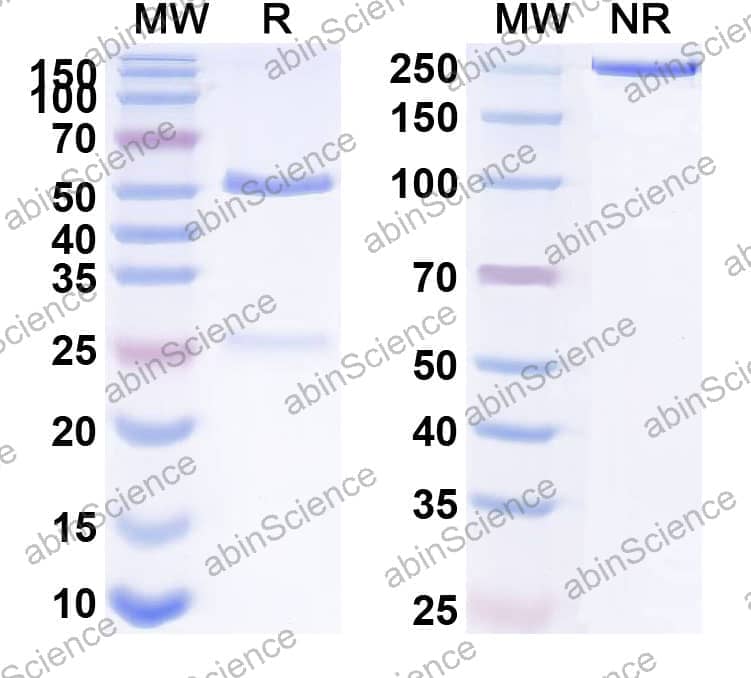 Anti-Human CST3/Cys C Monoclonal Antibody (1A385)