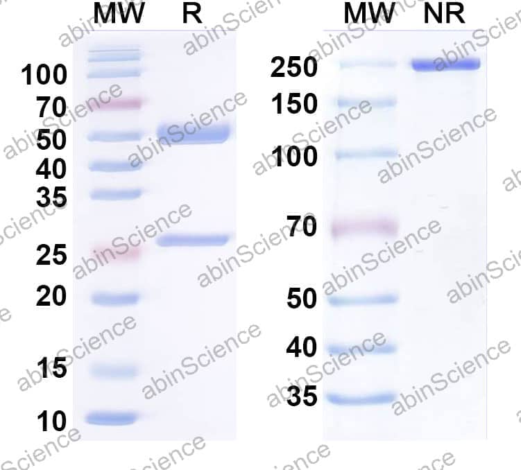 Anti-Human Adiponectin/Acrp30 Monoclonal Antibody (1A404)