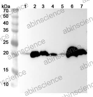 Anti-GPX1 Polyclonal Antibody