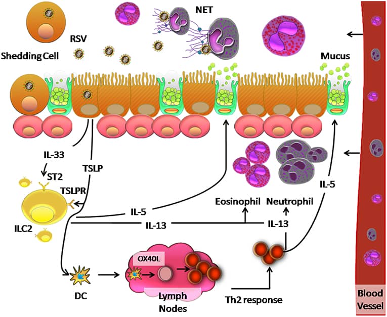 RSV Pathophysiology in Airways (2025)