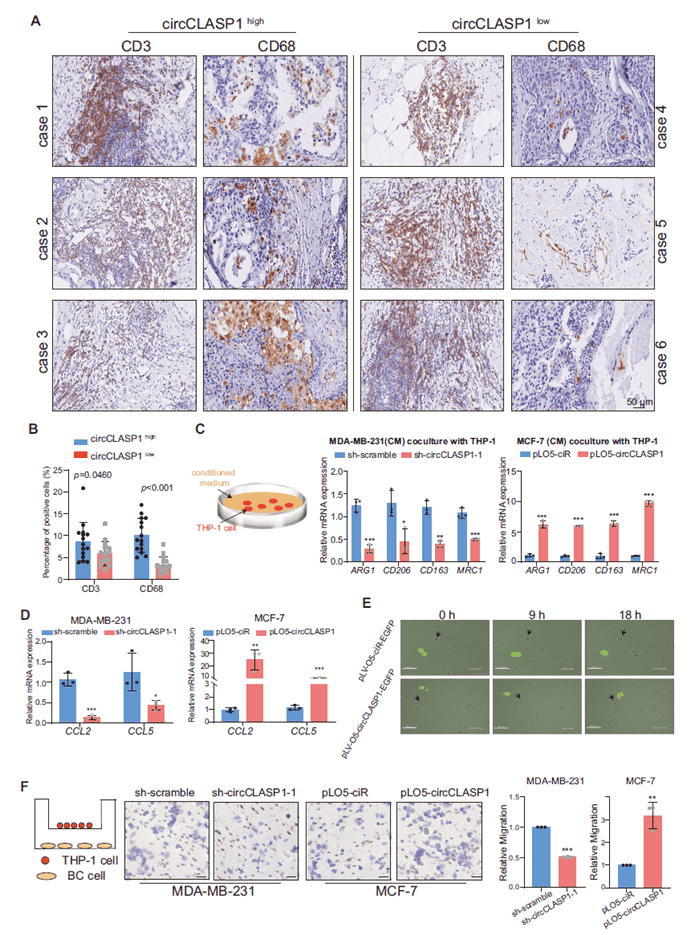 circCLASP1 enhances macrophage recruitment in breast cancer cells