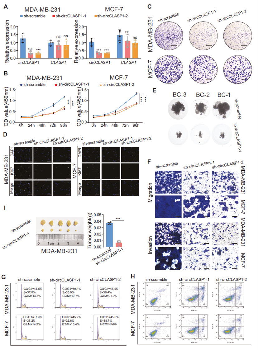 circCLASP1 functions as an oncogene in breast cancer cells