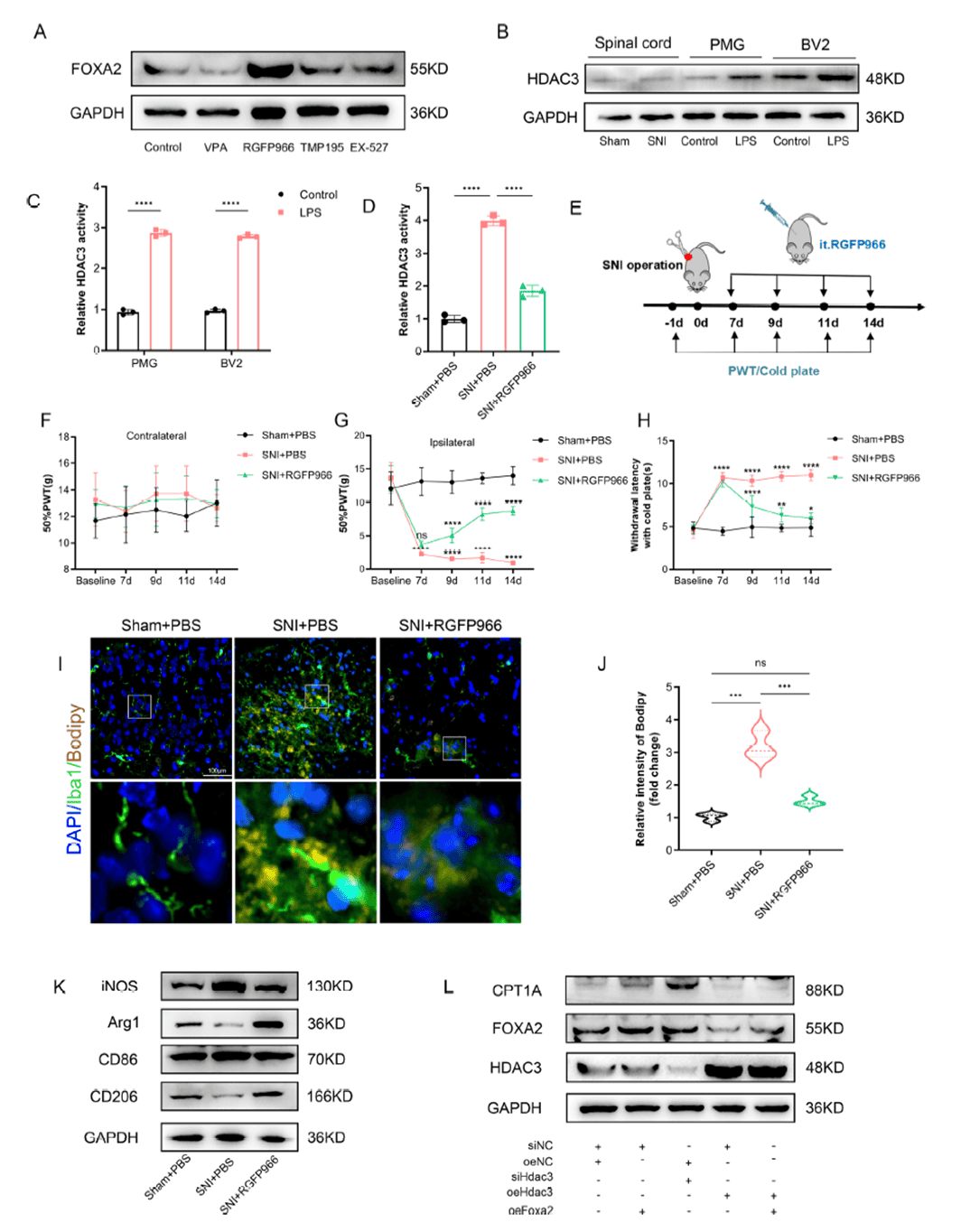 FOXA2 is regulated by HDAC3 activity and expression levels