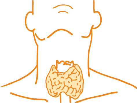 Тиреоидит Хашимото