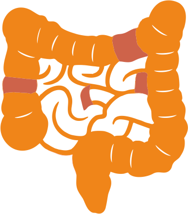 Болезнь Крона