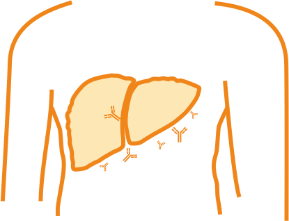 Аутоиммунный гепатит