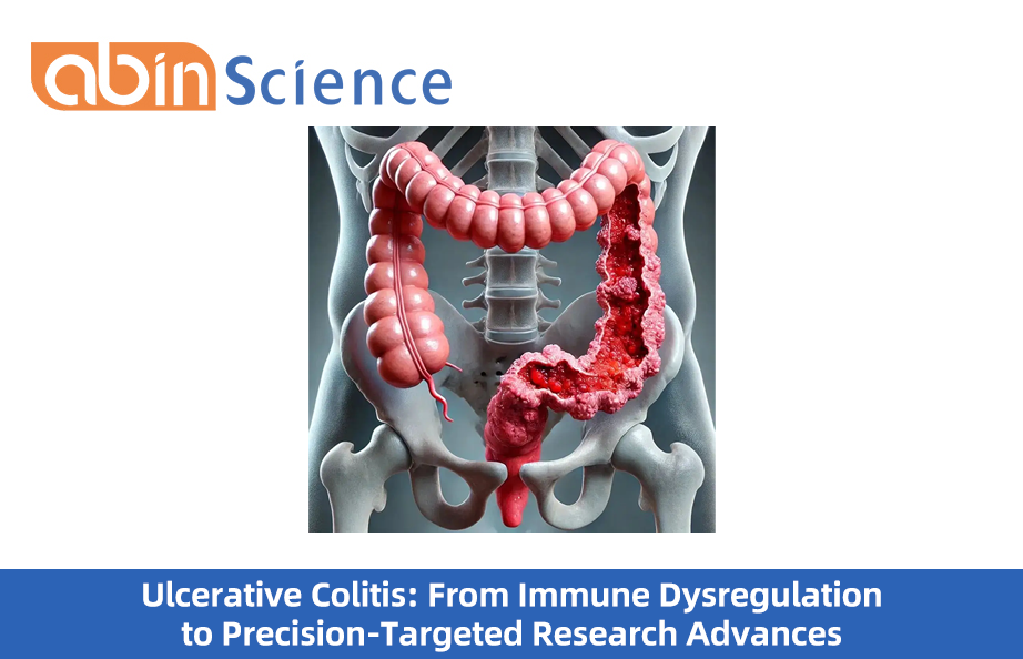 Ulcerative Colitis: From Immune Dysregulation to Precision-Targeted Research Advances