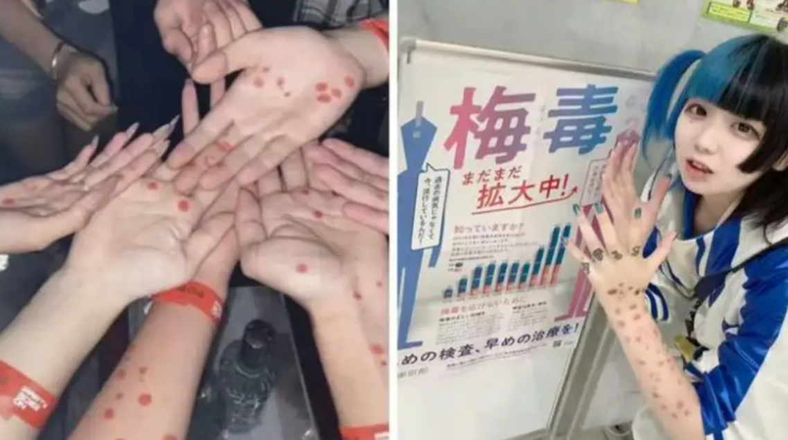 Social media infection showcase