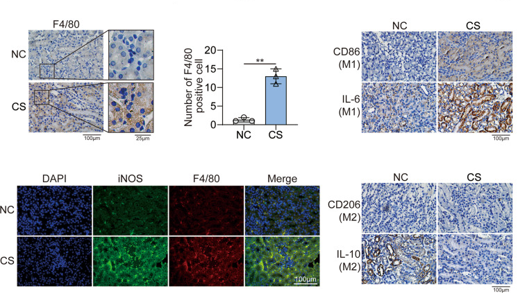 IHC/IF detection of macrophages