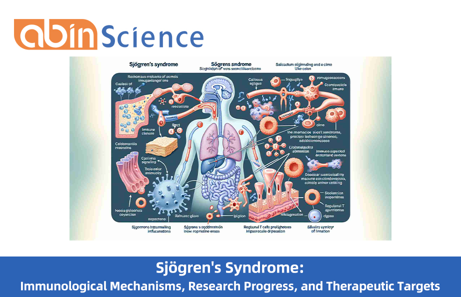 Sj&ouml;gren's Syndrome: Immunological Mechanisms, Research Progress, and Therapeutic Targets