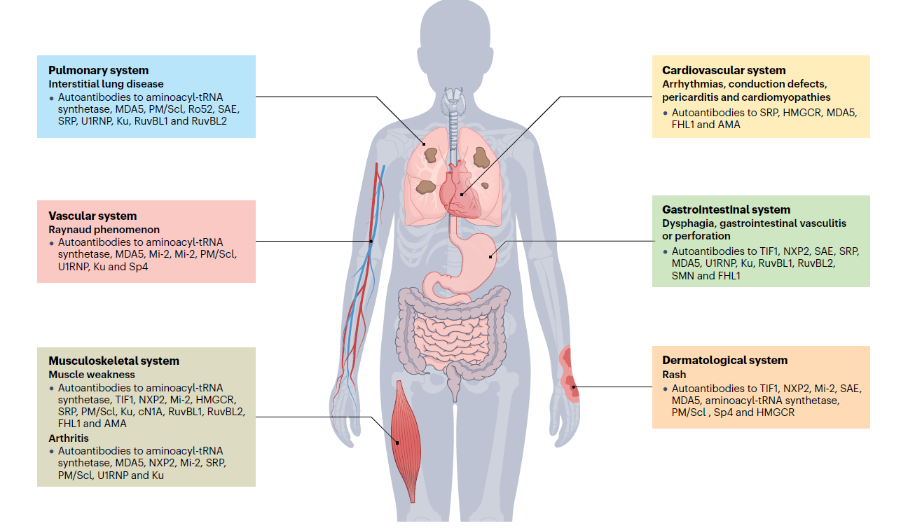 Manifestations of idiopathic inflammatory myopathies (IIM)