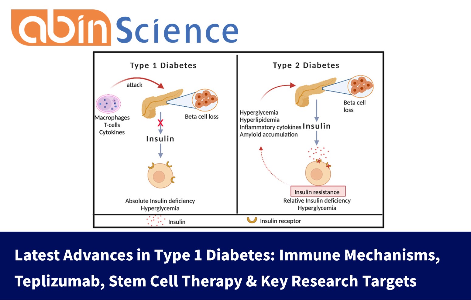 Latest Advances in Type 1 Diabetes: Immune Mechanisms, Teplizumab, Stem Cell Therapy & Key Research Targets