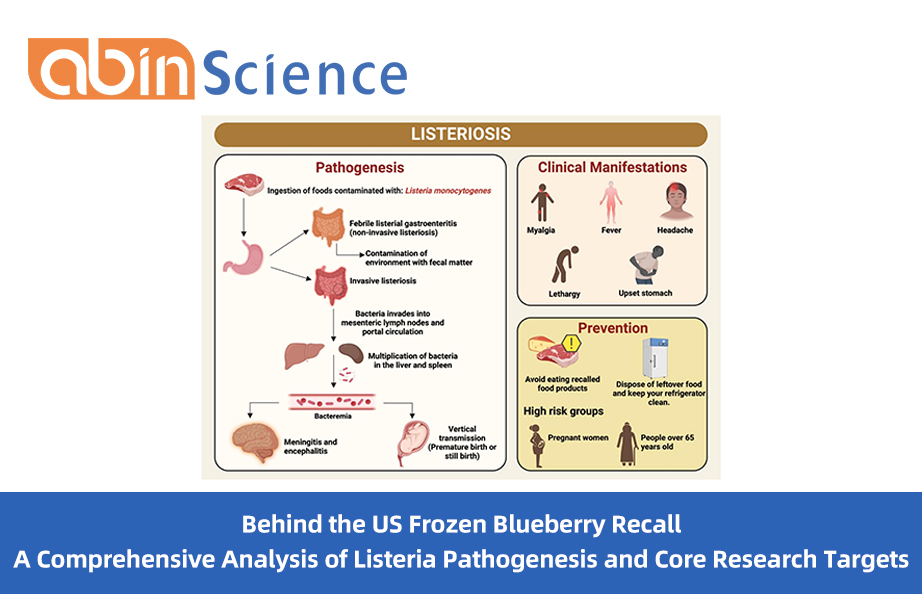 Behind the U.S. Frozen Blueberry Recall:Pathogenesis and Research Frontiers of Listeria monocytogenes