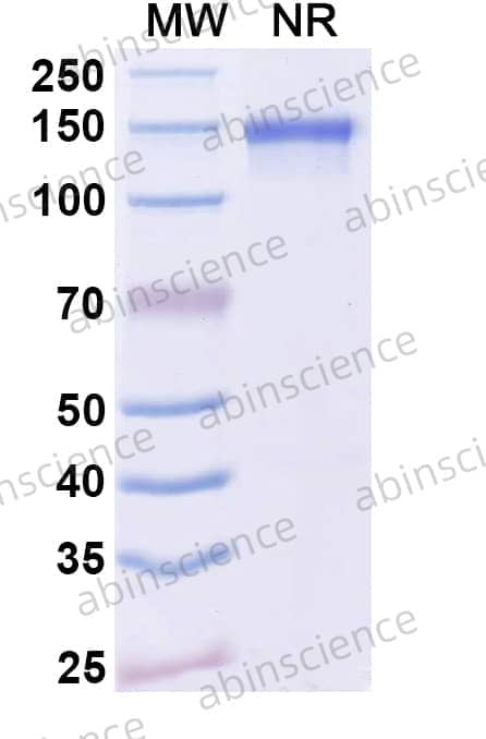 Anti-Dupilumab Neutralizing Antibody (SAA2182)