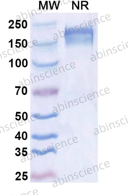 Anti-Dupilumab Neutralizing Antibody (SAA2183)