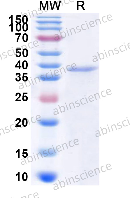 Recombinant Bovine CSN1S1/Bos d 8, N-His-SUMO