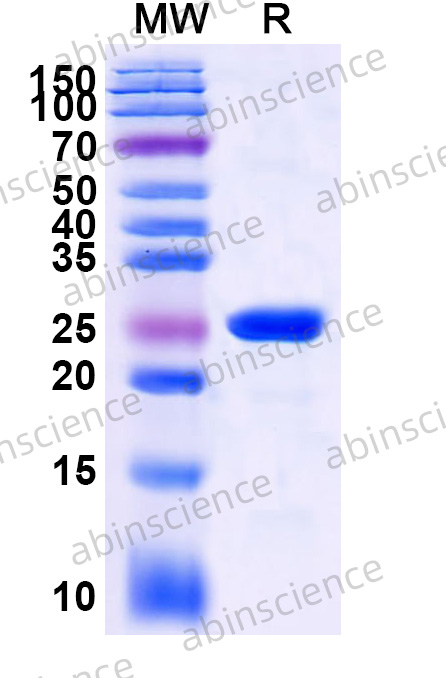 Recombinant Bovine Bos d 11/A1 beta-casein Protein, N-His