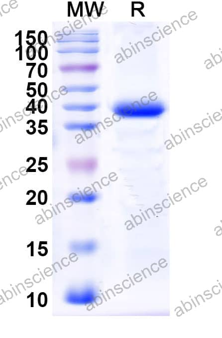 Recombinant Bovine ALB Protein, N-His