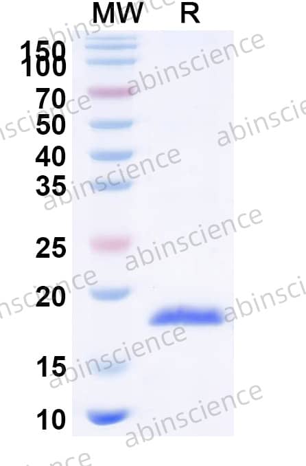 Recombinant Cat Fel d 4 Protein, N-His