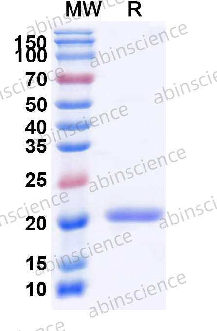 Recombinant Cat Fel d 7 Protein, N-His
