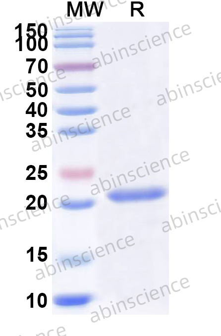 Recombinant Cat IL6 Protein, N-His