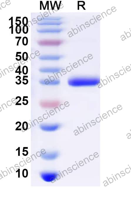 Recombinant Human MUC4 Protein, C-His