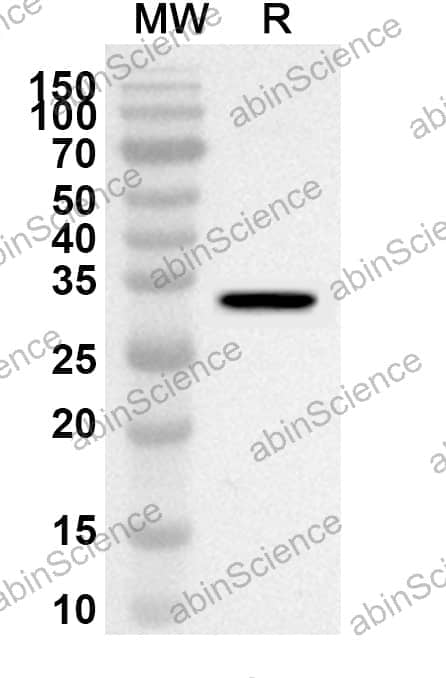 Anti-Human AMER1 Polyclonal Antibody