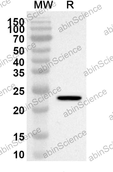 Anti-Human TRIM27 Polyclonal Antibody