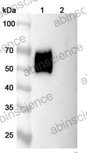 Anti-Human CD116/CSF2RA Antibody (CAM-3001)