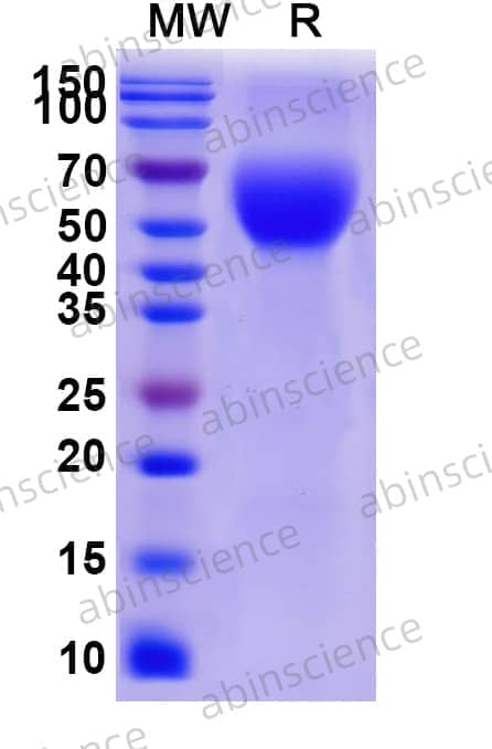 Recombinant Human CD66b/CEACAM8 Protein, C-His