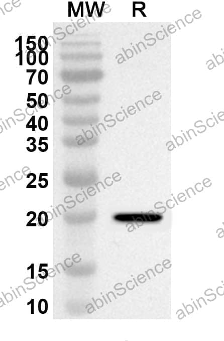 Anti-CCND1 Polyclonal Antibody