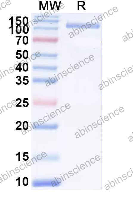 Recombinant Human TNFAIP3 Protein, N-GST