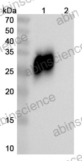 Research Grade Fanastomig