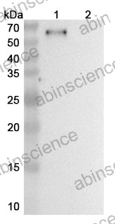 Research Grade Negalstobart