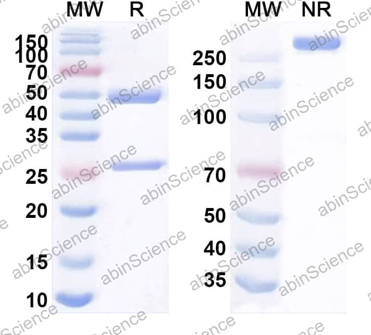 Anti-Human CD132/IL2RG Antibody (P1A10)