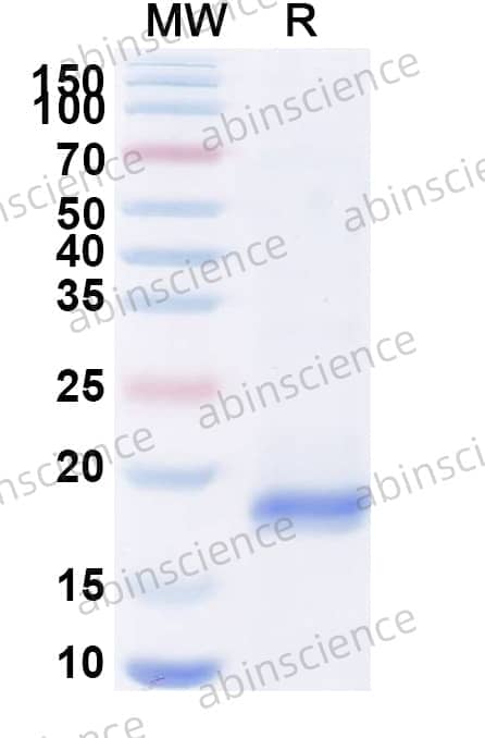Anti-Human CD124/IL4R/IL-4Rα Nanobody (SAA1420)