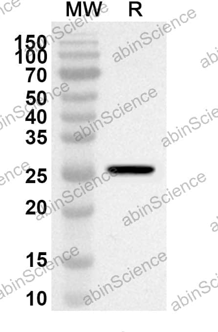 Anti-Human CD124/IL4R Polyclonal Antibody