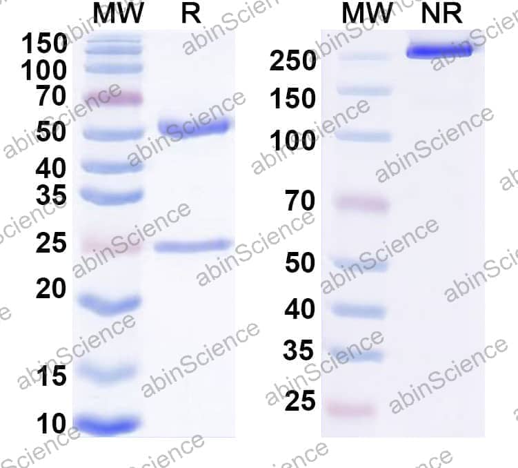 Anti-Human CD121a/IL1R1 Antibody (15C4)