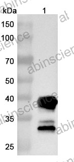 InVivoMAb Anti-Human CNR1/CB1 Nanobody (5D12)