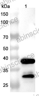 InVivoMAb Anti-Human CNR1/CB1 Nanobody (5G11)