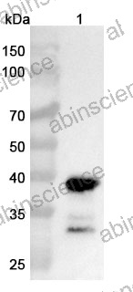 InVivoMAb Anti-Human CNR1/CB1 Nanobody (6B7)