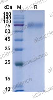Recombinant Human IFNAR1 Protein, C-His