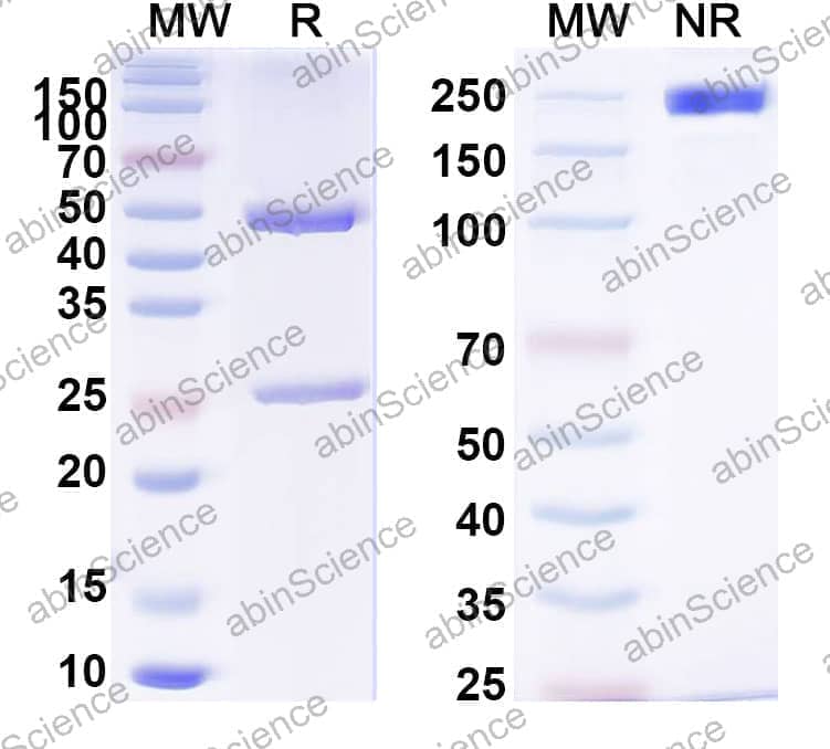 Anti-Human IFNAR1 Antibody (64G12)