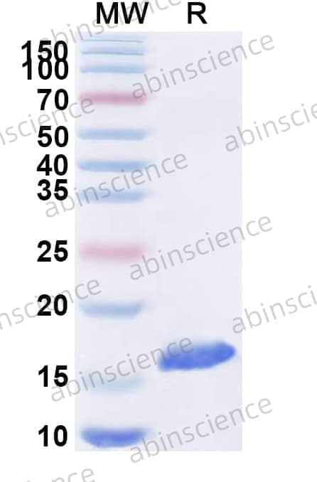 Anti-Human FOLR1 Nanobody (SAA2048)