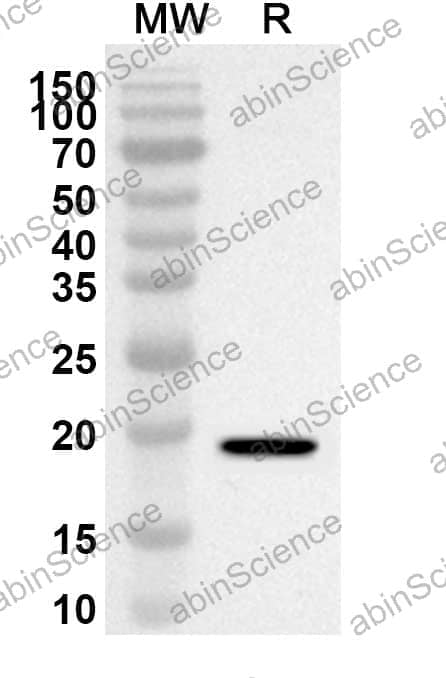 Anti-GFAP Polyclonal Antibody