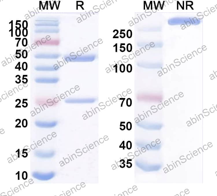 Anti-Human FSHR Antibody (9H11)