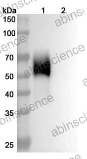 Recombinant Human CD334/FGFR4 Protein, C-His
