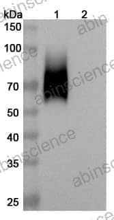 Recombinant Human CD66a/CEACAM1 Protein, C-His