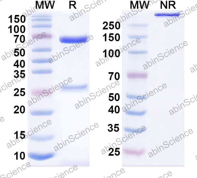 Anti-Human CD21/CR2 Antibody (SAA1459)
