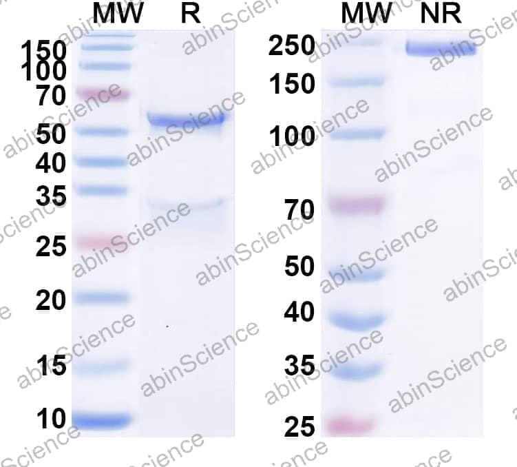 Anti-Human LTK Recombinant Antibody (SAA1618)